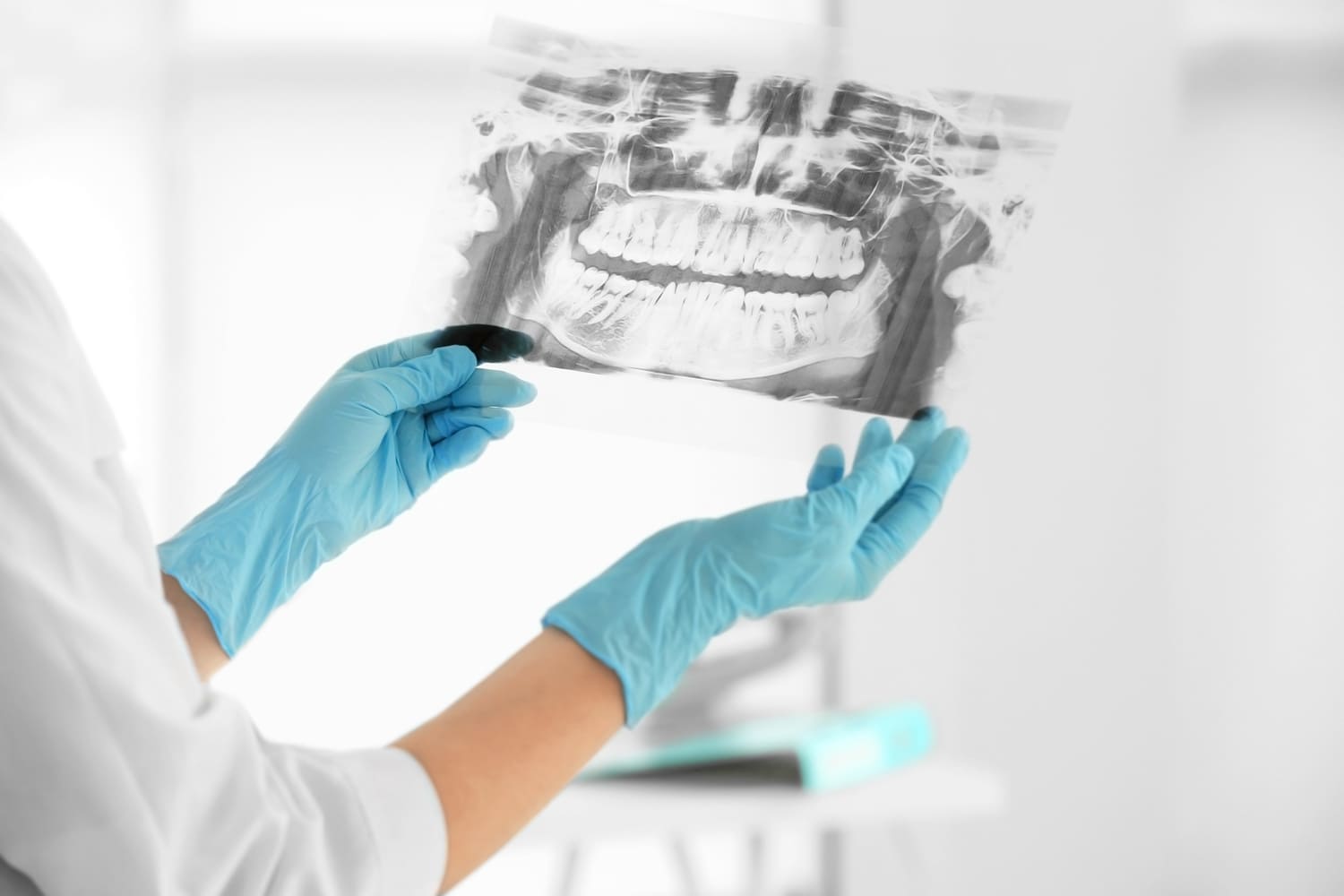 radiografía odontológica